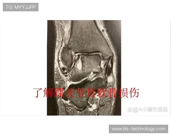 伊斯科坦言软骨损伤难彻底康复